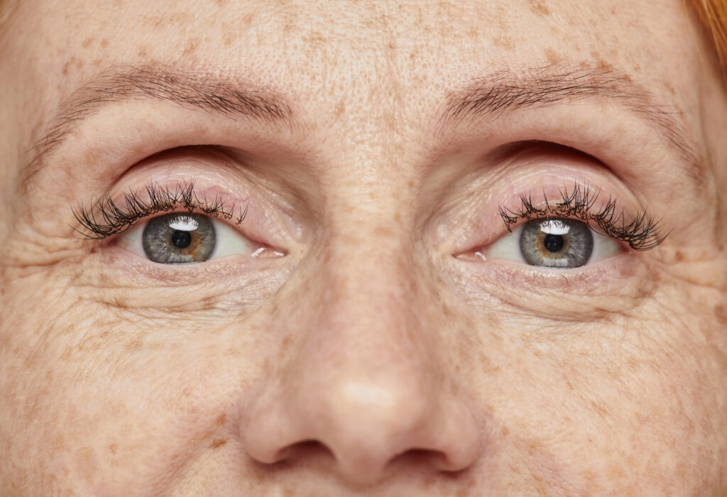 A close-up of a young freckled woman's eyes and nose.